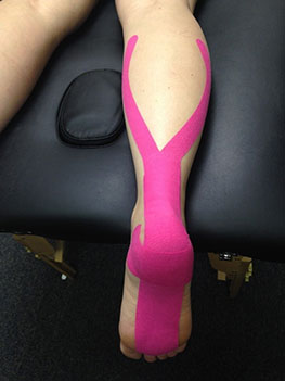 Kinesio Taping