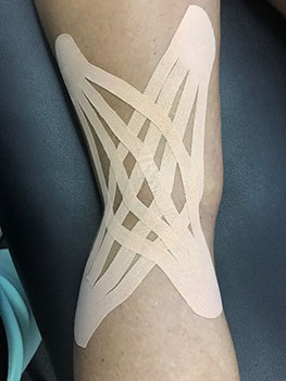 Kinesio Taping