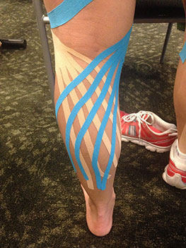 Kinesio Taping