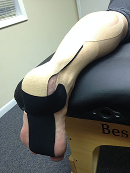 Kinesio Taping