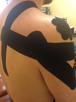 Kinesio Taping